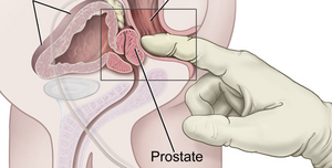 What Is A Prostate Massager, And How Do You Use It?